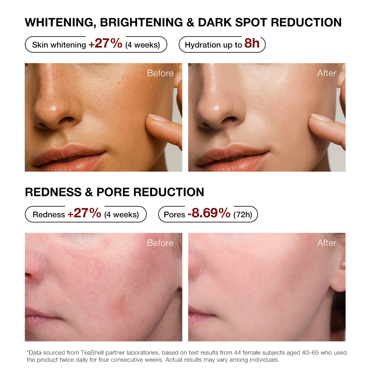 Teashell 5% Niacinamide Brightening Serum - Vitamin C + Alpha Arbutin, 30ml